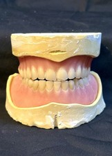 Vintage Denture Training Model. Dental Typodonts.  1980’s. Complete Set