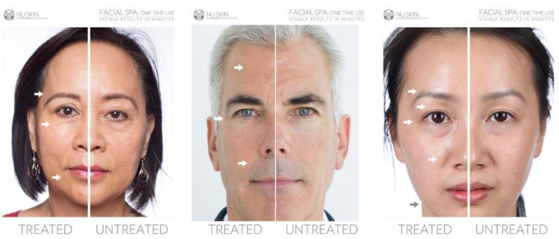 AgeLOC Galvanic Spa with interchangable heads - White AgeLOC Galvanic Spa with interchangable heads - White