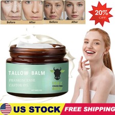 Tallow Balm Moisturizing Cream Frankincense Castor Oil 30g NEW
