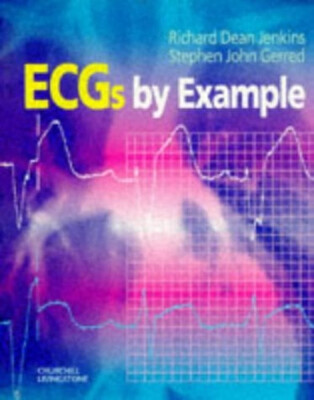 EKGs nach Beispiel Taschenbuch
