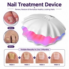 Toenail Fingernail Fungus Laser Treatment Device for Onychomycosis Cleaning
