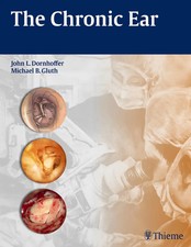 The Chronic Ear | John L Dornhoffer (u. a.) |...