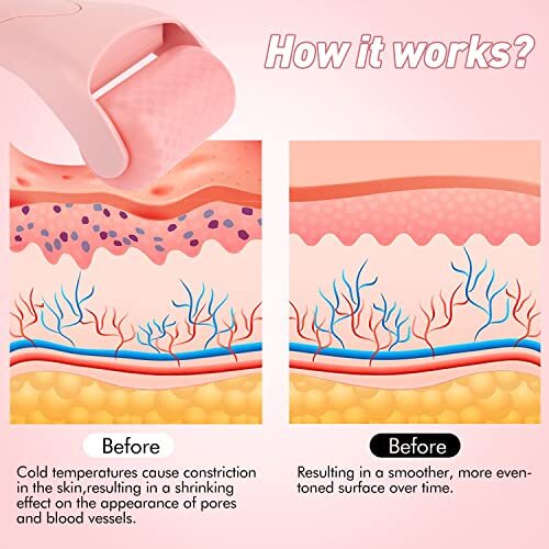 Reusable Ice Roller Facial Tool for Puffiness Migraine Relief Minor Injury - Zdjęcie 6 z 7