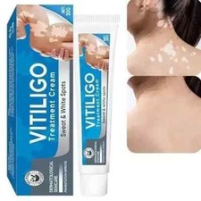 Vitiligo Treatment, Vitiligo Cream Improve Sk...