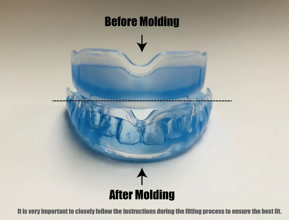 Boil and bite mouth guard deals