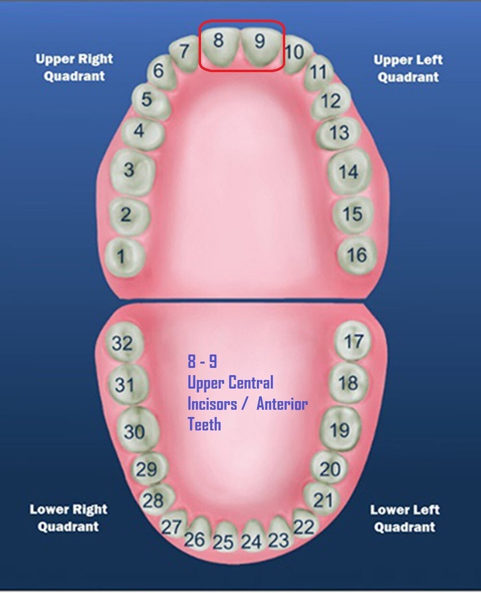 CORONE POLICARBONATO SUPER SILVER 24 5PZ - Foto 6