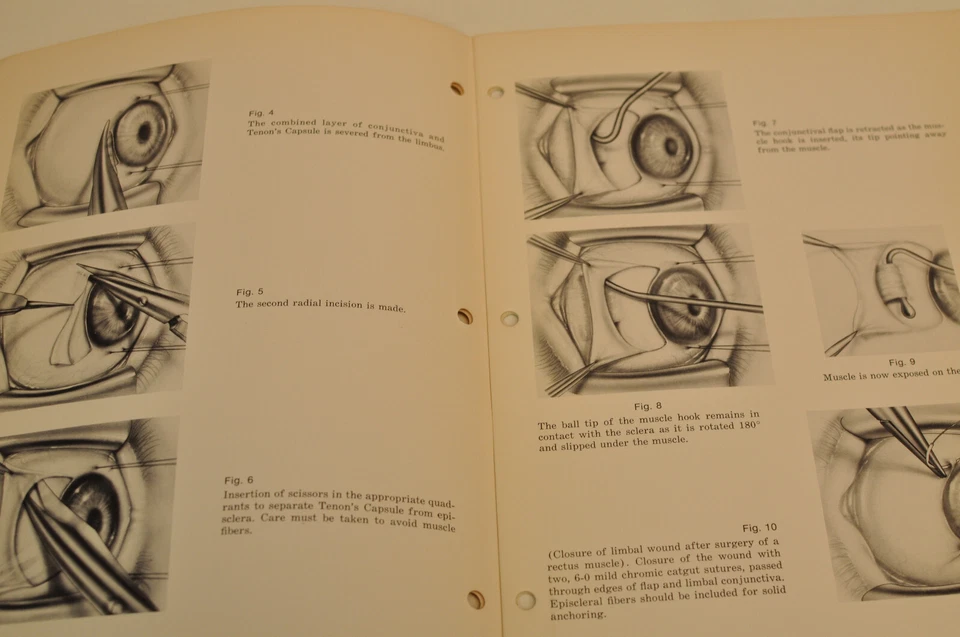 Vintage Ethicon 1972 Technics In Surgery - Strabismus Surgery by Gunter Noorden — 第 3/4 张图片
