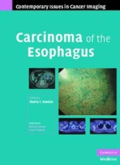 Carcinoma of the Esophagus (Contemporary Issues in Cancer Imagin