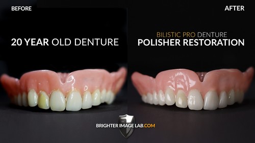 Pulidora de dentaduras Bilistic Pro | Limpiador de dentaduras profesional - Imagen 4 de 4