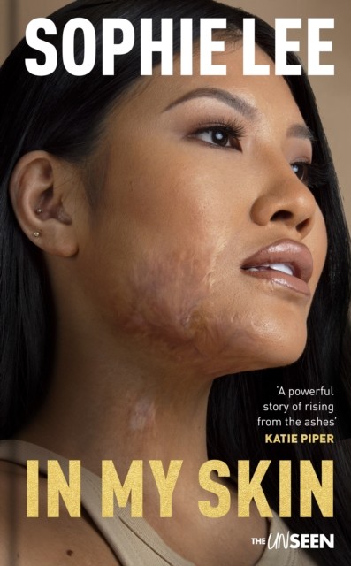In My Skin by Sophie Lee (Hardback Book)