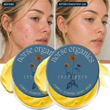 NEW Norse Organics Pimple Stopper Night Balm 1oz Acne Spot Treatment
