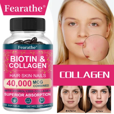 FEARATHE Collagene e Biotina - 40000mcg Capsule per la Crescita dei Capelli, Pelle e Unghie Sane