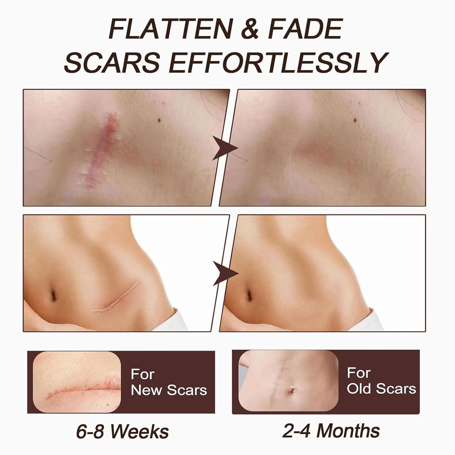 Silicone Scar Stick,containing 60% silicone scar repair ingredients,fades scars.