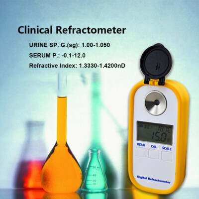 urine refractometer serum