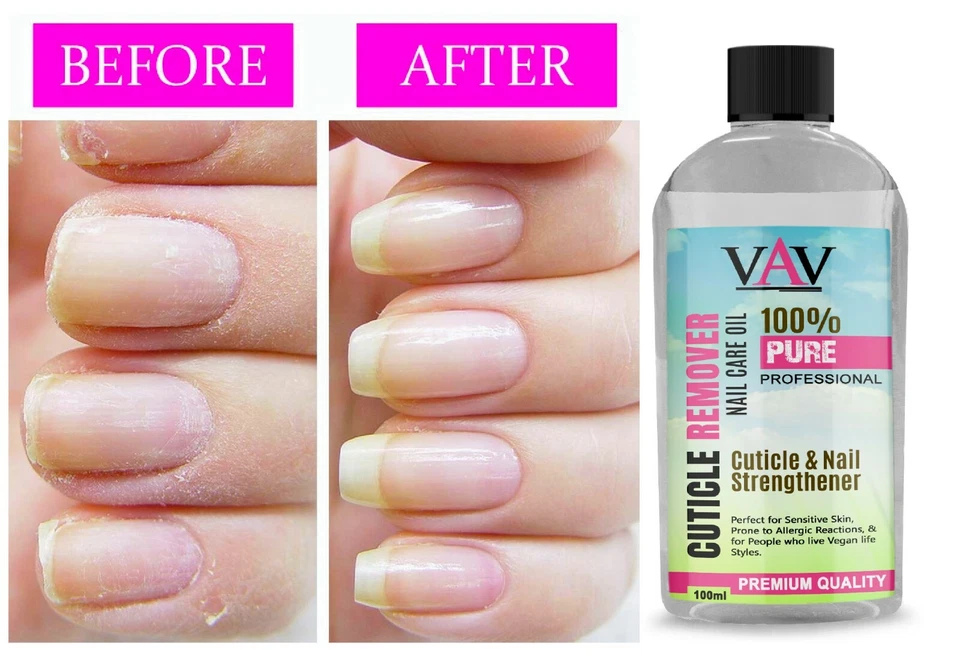 VAV Strictly Professional Creamy Erweicht & Entfernt überschüssigen Nagelhautentferner 100ml