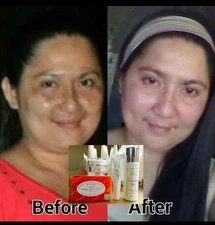 Dr. Alvin PSCF Rejuvenating Set Whitening Melasma Dark Spot Acne Pimples