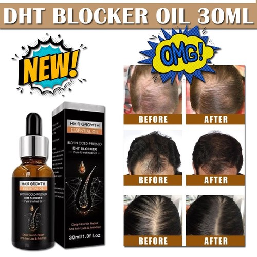 DHT Blocker for Men DHT Blocker for Women Men Growth Serum for Hair