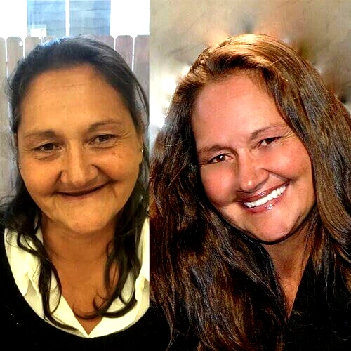 DIY DENTURE KIT Custom Dentures made at home  FREE Priority  Ship  FULL  PARTIAL - Image 2 of 4