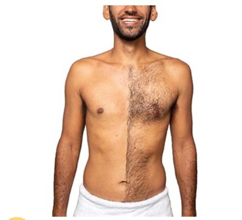 Bakblade 2.0 Back Hair Removal & Body Shave Wet Or Dry - Picture 4 of 10