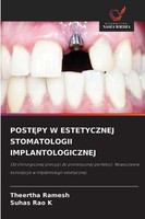 Post¿Py W Estetycznej Stomatologii Implantologicznej Theertha Ramesh
