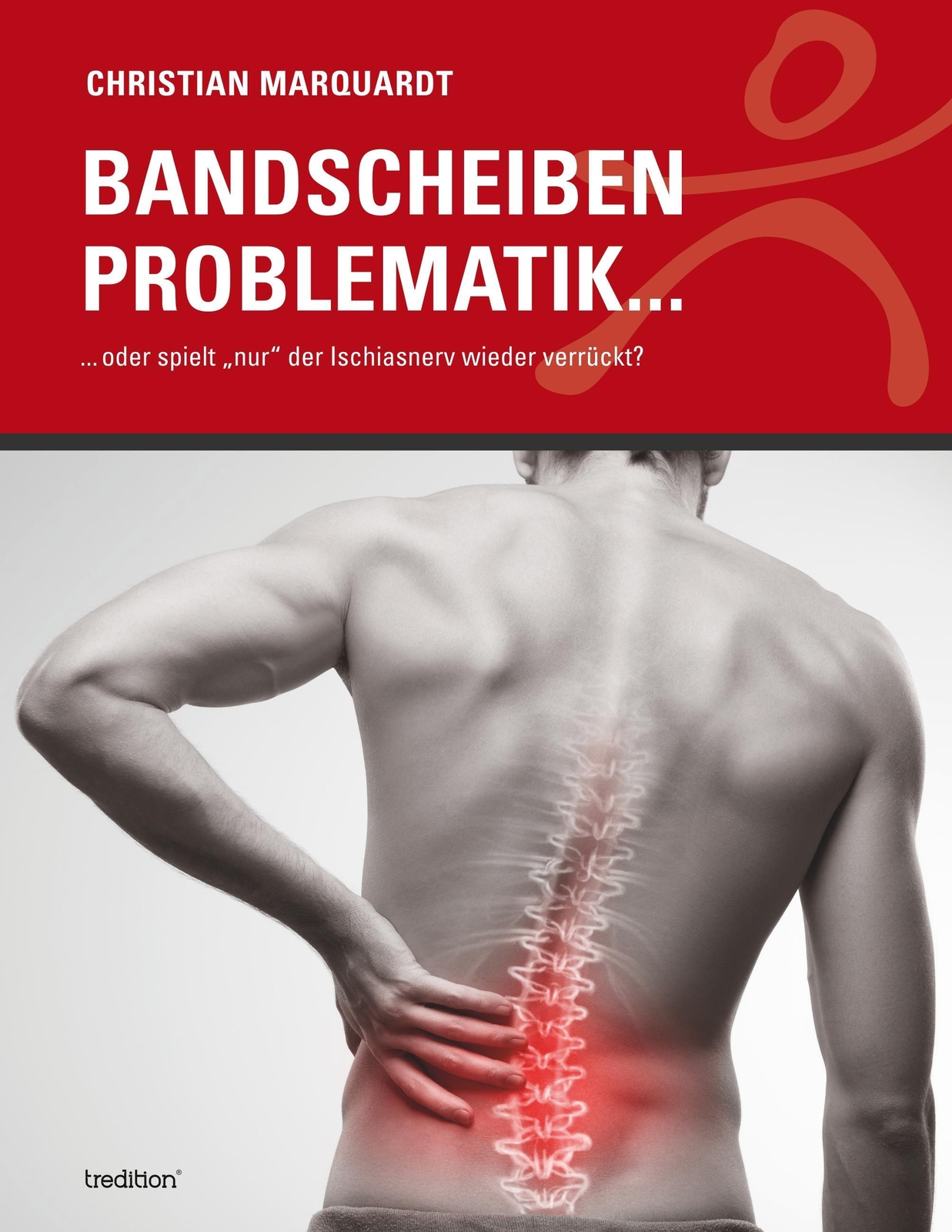 Thumbnail - Christian Marquardt | Bandscheiben Problematik | Taschenbuch | Deutsch