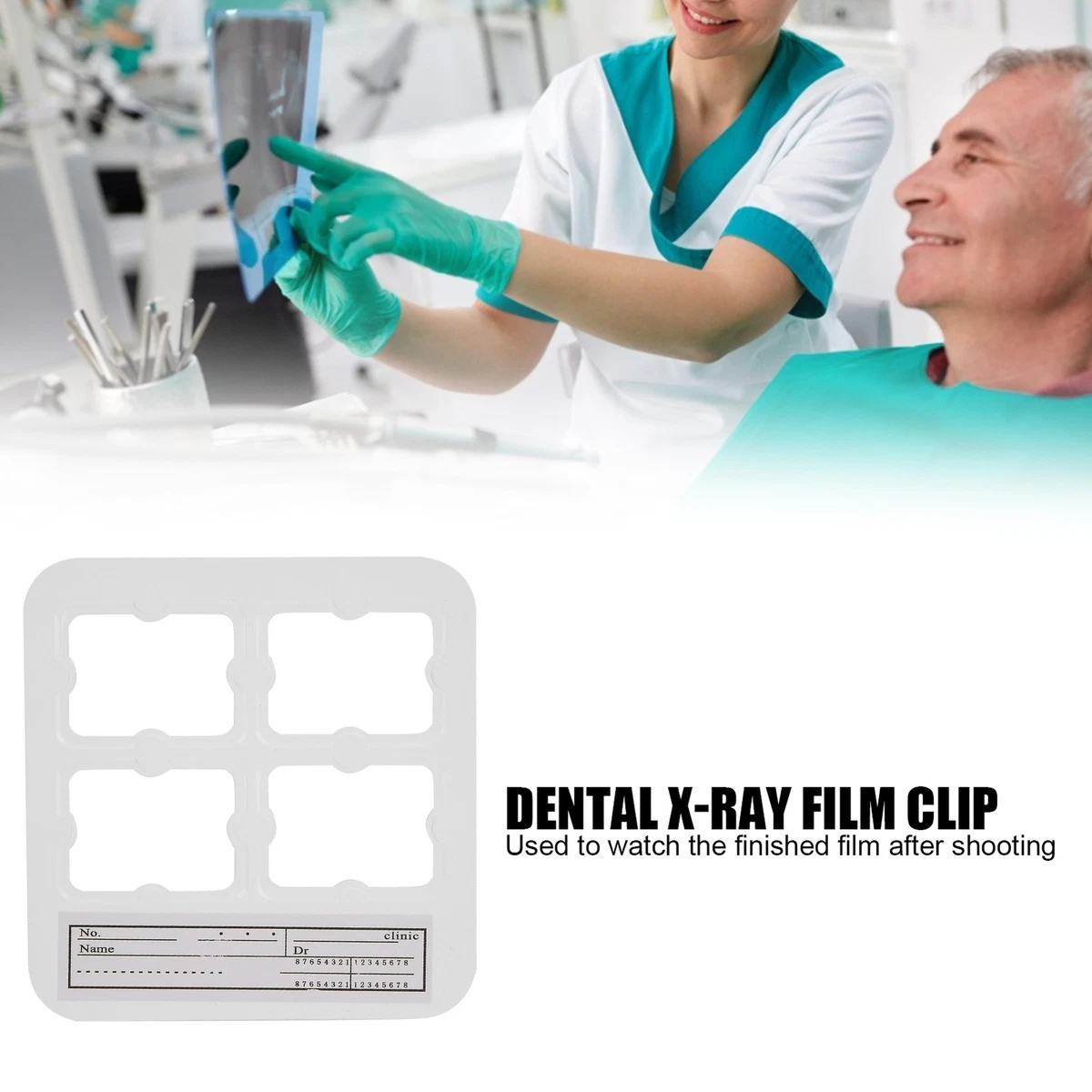 X Ray Holes