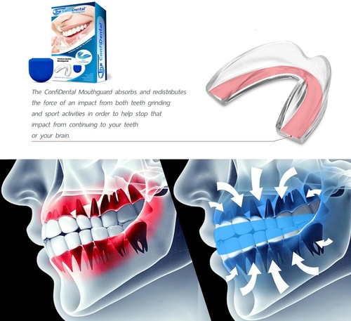 - Pack of 3 Moldable Mouth Guard for Teeth Grinding Clenching Bruxism Sport A... - Picture 6 of 8