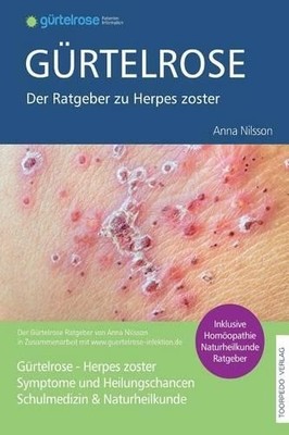 Fr Anna Nilsson Anna N Gürtelrose - Der große Ratgeber zu Herpes  (Taschenbuch)