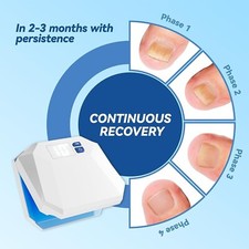 LED Nail Fungus Device for Toenail Fingernails  Onychomycosis, NEW IN BOX