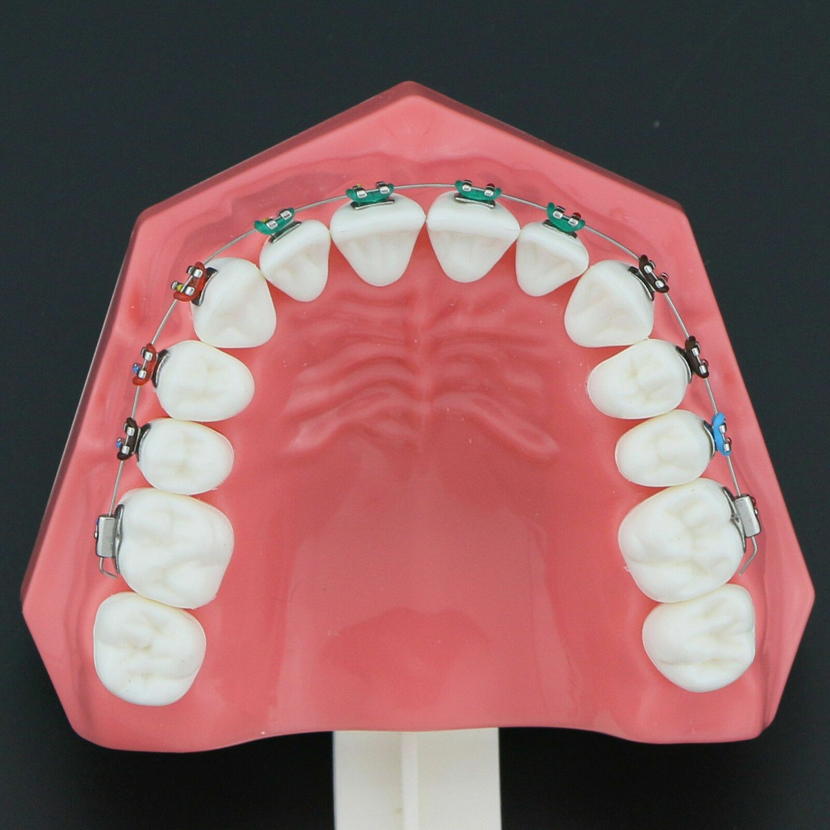Dental Orthodontic Typodont Teeth Model With Self-Ligating Metal Dental Orthodontic Typodont Teeth Model With Self-Ligating Metal