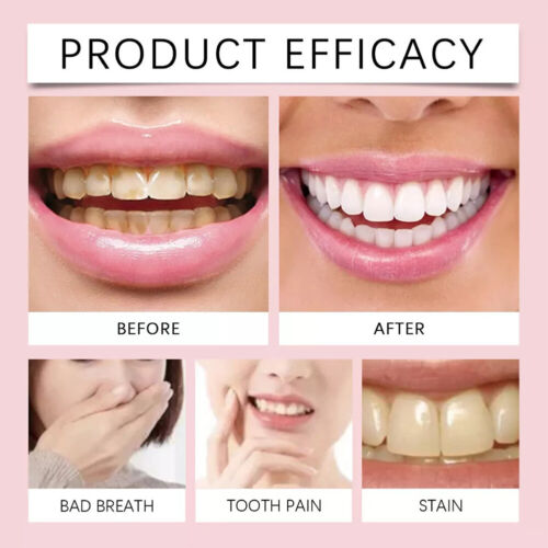 SP-6 Probiotic Toothpaste Teeth Whitening Stain Removing Brightening Deep Clean - Picture 13 of 19