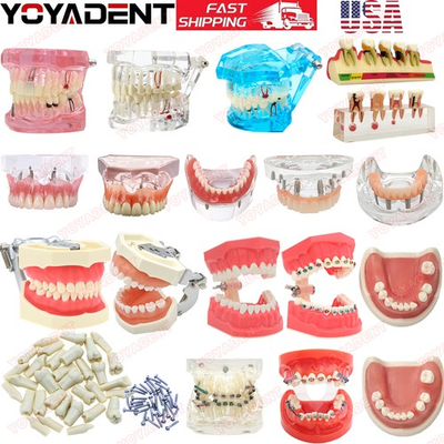 #ad #ad US Dental teeth Model Preparation Training Teaching Ortho Implant Typodont Demo $83.96