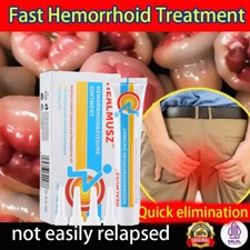 Hemorrhoids Remove Ointment Herbal Cream Relief Piles Pain Reduce Itching 42.5g