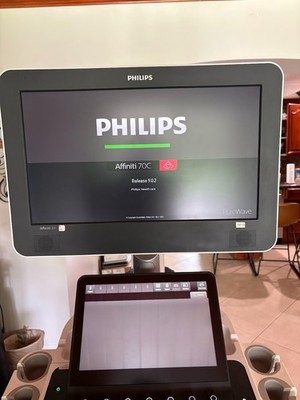 PHILIPS  AFFINITI 70C ULTRASOUND 2017