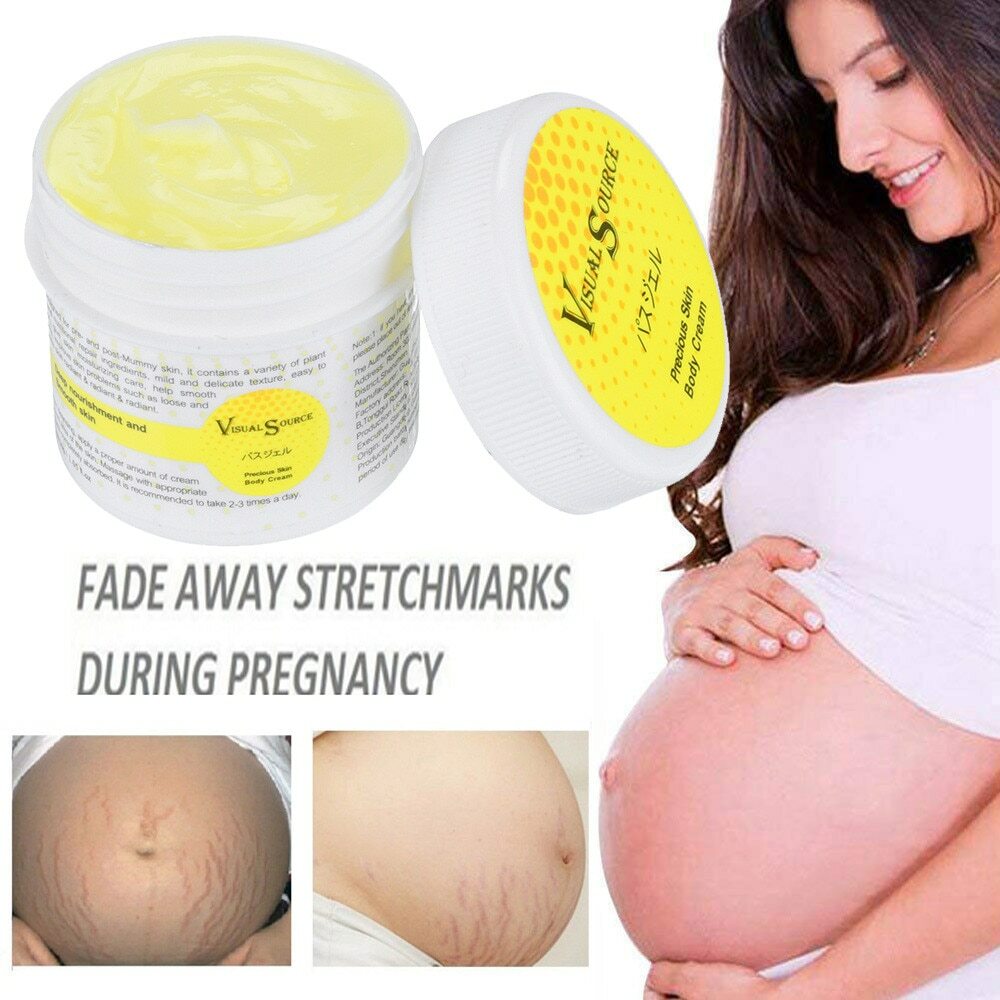 striae out cream