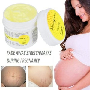 fat stretch marks removal cream