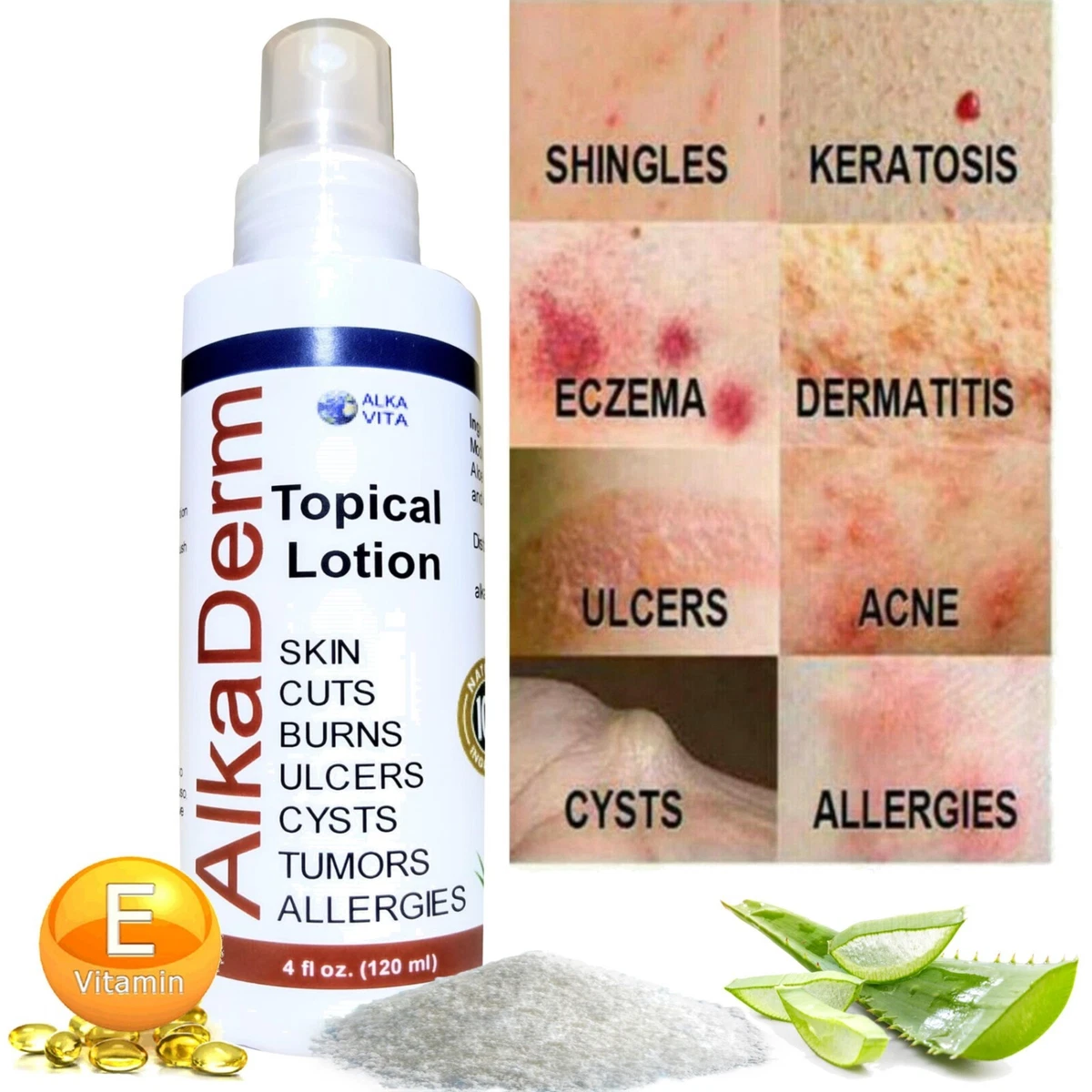 Can Dogs Have Eczema Or Psoriasis