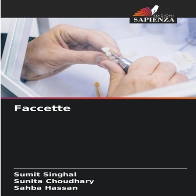Faccette SUMIT SINGHAL Paperback KS OmniScriptum Publishing