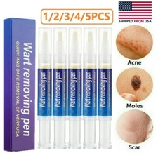 12H Wart Remover Pen Skin Tag Mole Remover Eliminate Foot Corn Warts Unisex 