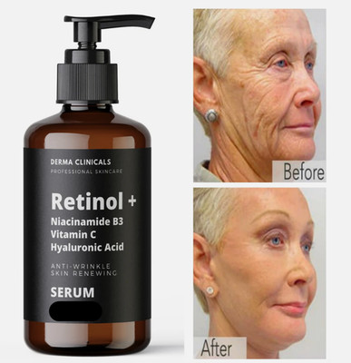 Retinol, Niacinamide, Vitamin C, Hyaluronic Acid, AntiAging Wrinkle SERUM - 8oz