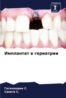 Gaganashree S. (U. A.) | Implantat W Geriatrii | Taschenbuch | Russisch (2023)