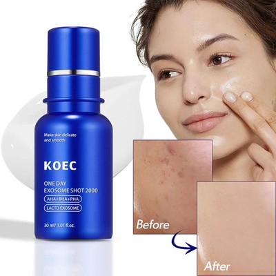 KOEC ONE DAY EXOSOME SHOT 2000 Face Serum