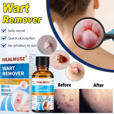 #ad HEALMUSZ Plantar Warts Remover for Body Natural Salicylic Acid Fast Acting Hot $11.75