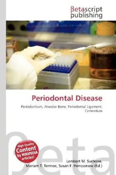 Lambert M. Surhone (U. A.) | Periodontal Disease | Taschenbuch | Englisch (2026)-image