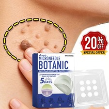 MICRONEEDLE BOTANIC Skin Tag  Acne Patch Skin Tag Remover Patches 9Pcs HOT 2025