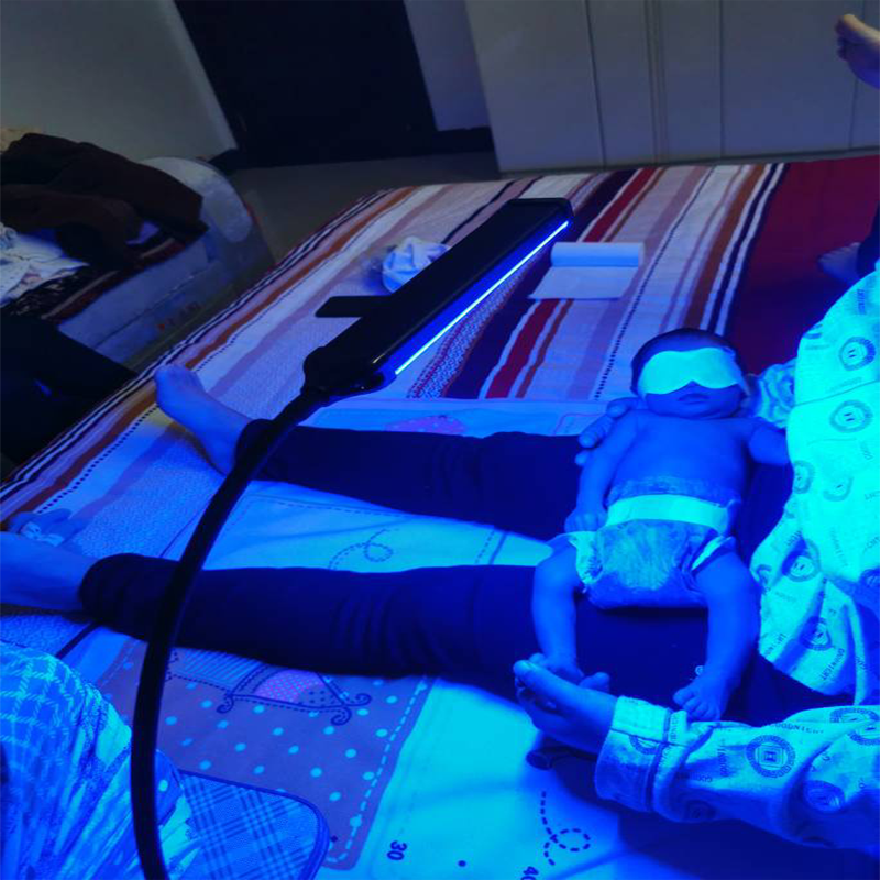 Jaundice blue light neonatal jaundice blue light reduces jaundice in