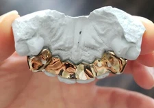 Silver or 10K Gold K9s w/Fullback Custom Grillz