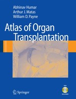 Atlas Of Organ Transplantation Abhinav Humar (U. A.) Taschenbuch Englisch 2008