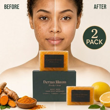 Kojic Acid Soap Bar, Vitamin C, Retinol, Turmeric, for Dark Spots - 2 Pack