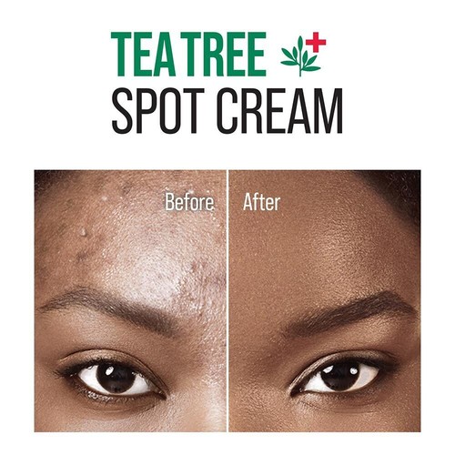 KISS NEW YORK TEEBAUM SPOT CREME mit SALICYLSÄURE & CICA #TT03 - Bild 5 von 9